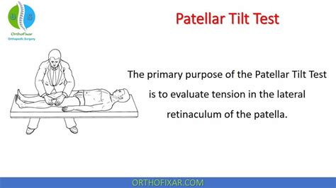 patellar compression test|patellar tilt test positive.